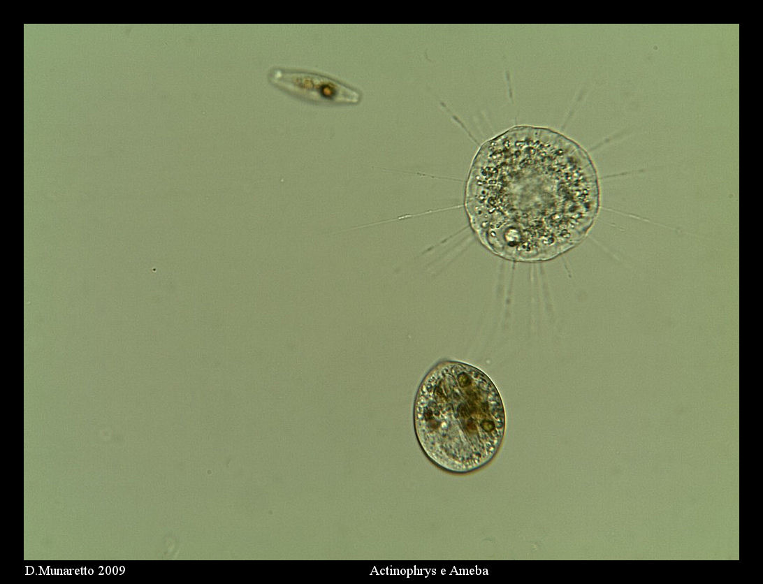 Actinophrys VS Tecameba